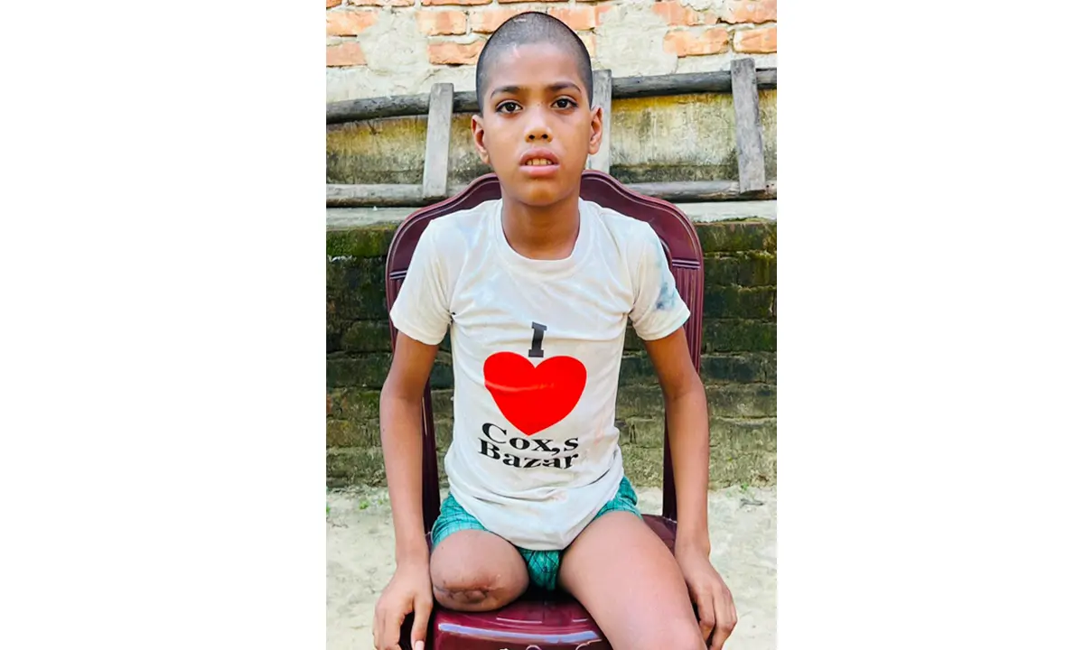 চুল কাটতে বের হওয়া রায়হান ফিরল এক পা হারিয়ে