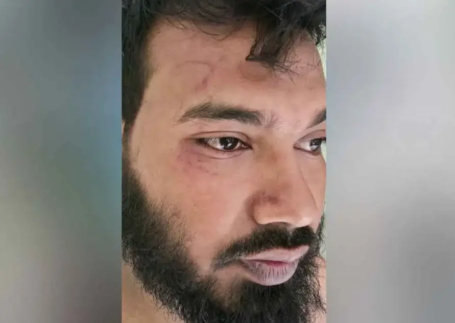 চট্টগ্রামে বনের জমিতে উচ্ছেদ অভিযানে বন কর্মকর্তাকে মারধর