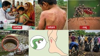 বন্যার পানি নামার পর বাড়ছে ডায়রিয়া-চর্মরোগ, সঙ্গে ডেঙ্গু