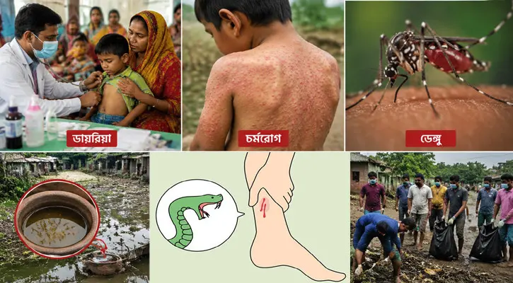 বন্যার পানি নামার পর বাড়ছে ডায়রিয়া-চর্মরোগ, সঙ্গে ডেঙ্গু
