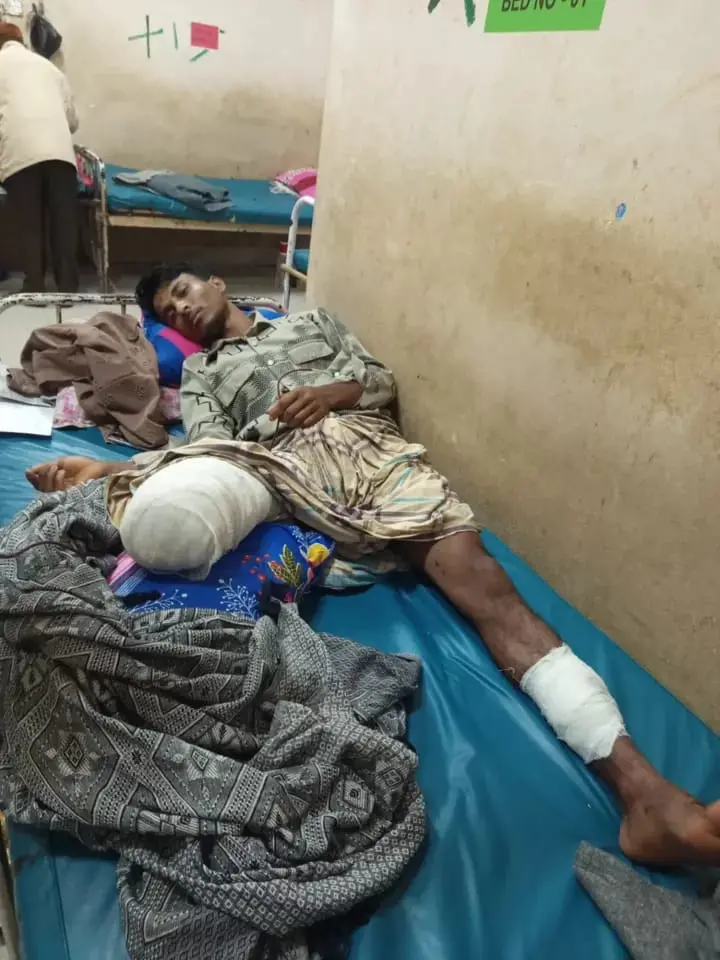 ঈদগাঁওয়ে লবণ কারখানার মেশিনে শ্রমিকের পা বিচ্ছিন্ন