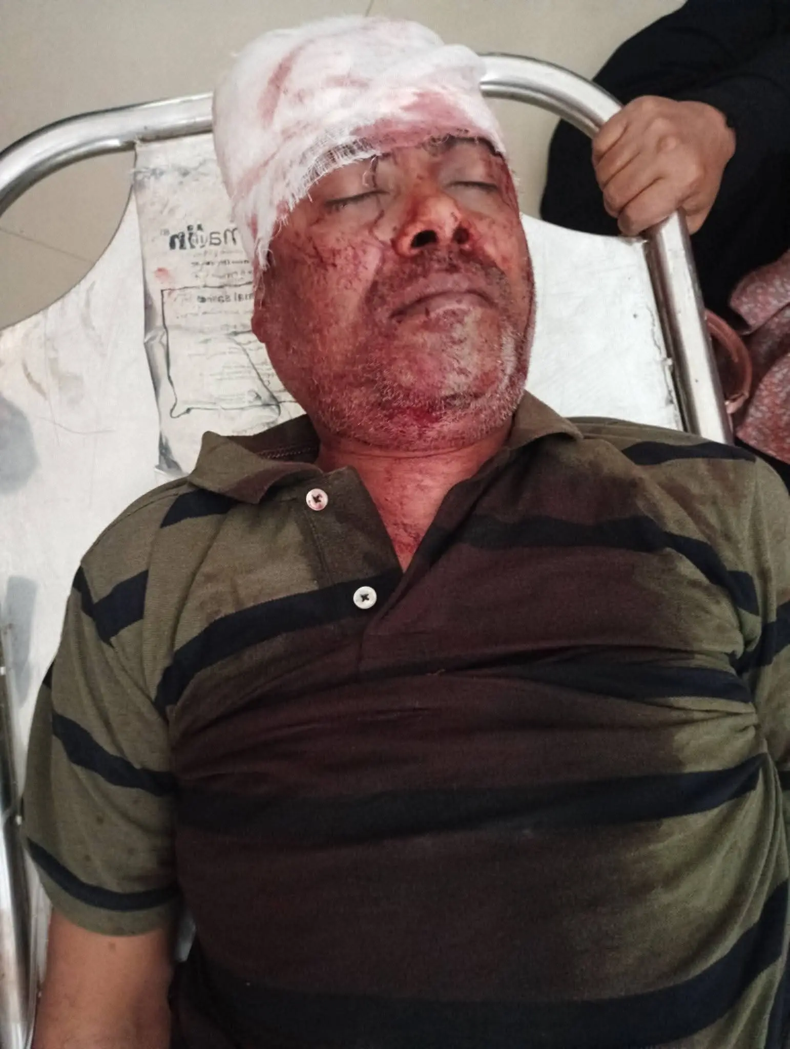 চকরিয়ায় বেপরোয়া টমটমের ধাক্কায় ব্যবসায়ীর মর্মান্তিক মৃত্যু