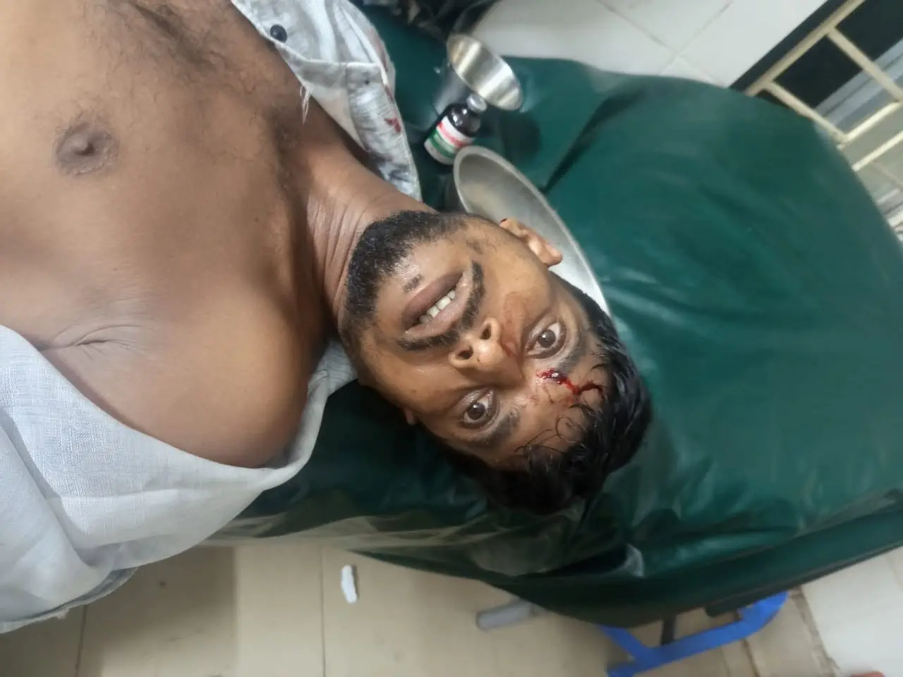 বাঁশখালীর মনকিচরে গান-বাজনা বন্ধ করতে বলায় হামলা, আহত ৩
