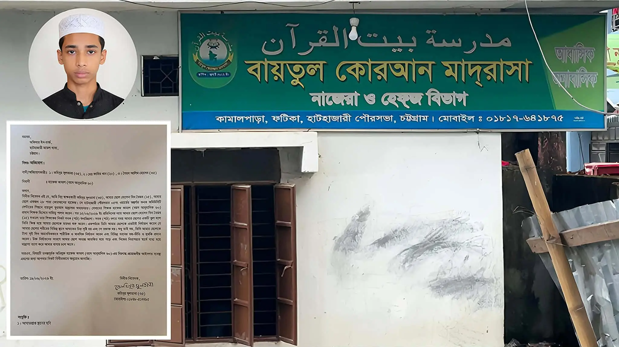 পাঠ ভুলের অভিযোগে শিশু হাফেজকে নির্মম নির্যাতন,প্রধান শিক্ষকের বিরুদ্ধে থানায় অভিযোগ