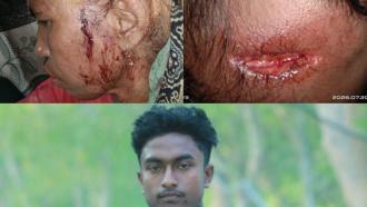 বাঁশখালীতে বিশ্বকাপ খেলা নিয়ে কথাকাটাকাটির জেরে হামলা, গুরুতর আহত মা-মেয়ে