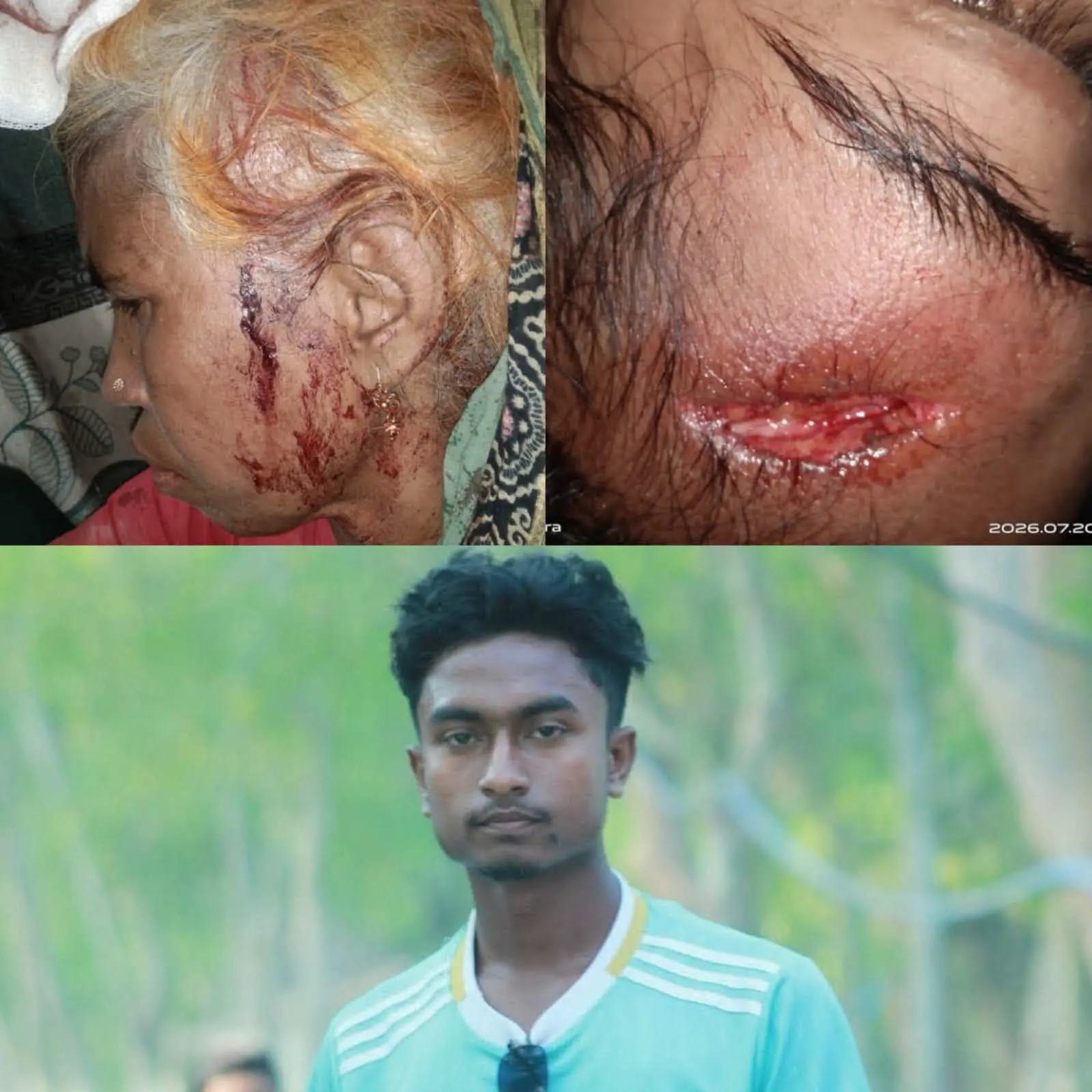 বাঁশখালীতে বিশ্বকাপ খেলা নিয়ে কথাকাটাকাটির জেরে হামলা, গুরুতর আহত মা-মেয়ে