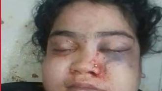 নাইক্ষ্যংছড়িতে গৃহবধূর মৃত্যুর ঘটনায় স্বামী আটক