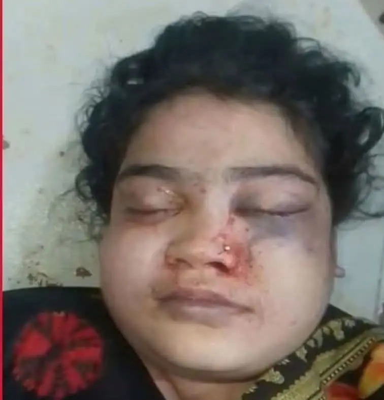 নাইক্ষ্যংছড়িতে গৃহবধূর মৃত্যুর ঘটনায় স্বামী আটক