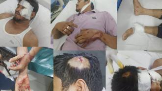 গরুর রশিতে পঁচিয়ে সিএনজি অটোরিকশা দুর্ঘটনা: মালিকপক্ষের হামলায় পুলিশের এএসআইসহ আহত ৪