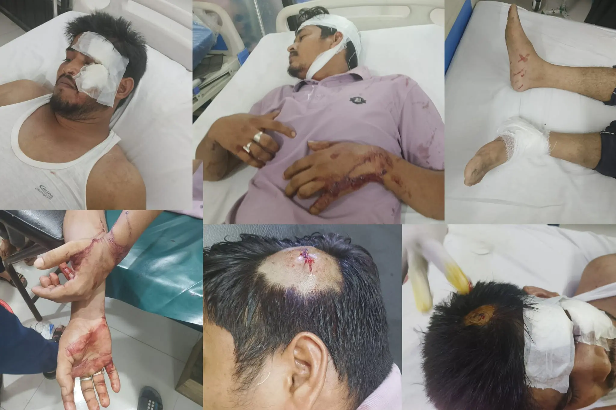 গরুর রশিতে পঁচিয়ে সিএনজি অটোরিকশা দুর্ঘটনা: মালিকপক্ষের হামলায় পুলিশের এএসআইসহ আহত ৪