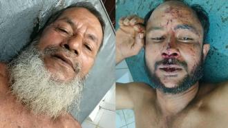 ইভটিজিং মামলায় জামিনে বেরিয়ে বাদীর ওপর হামলা, আহত ২