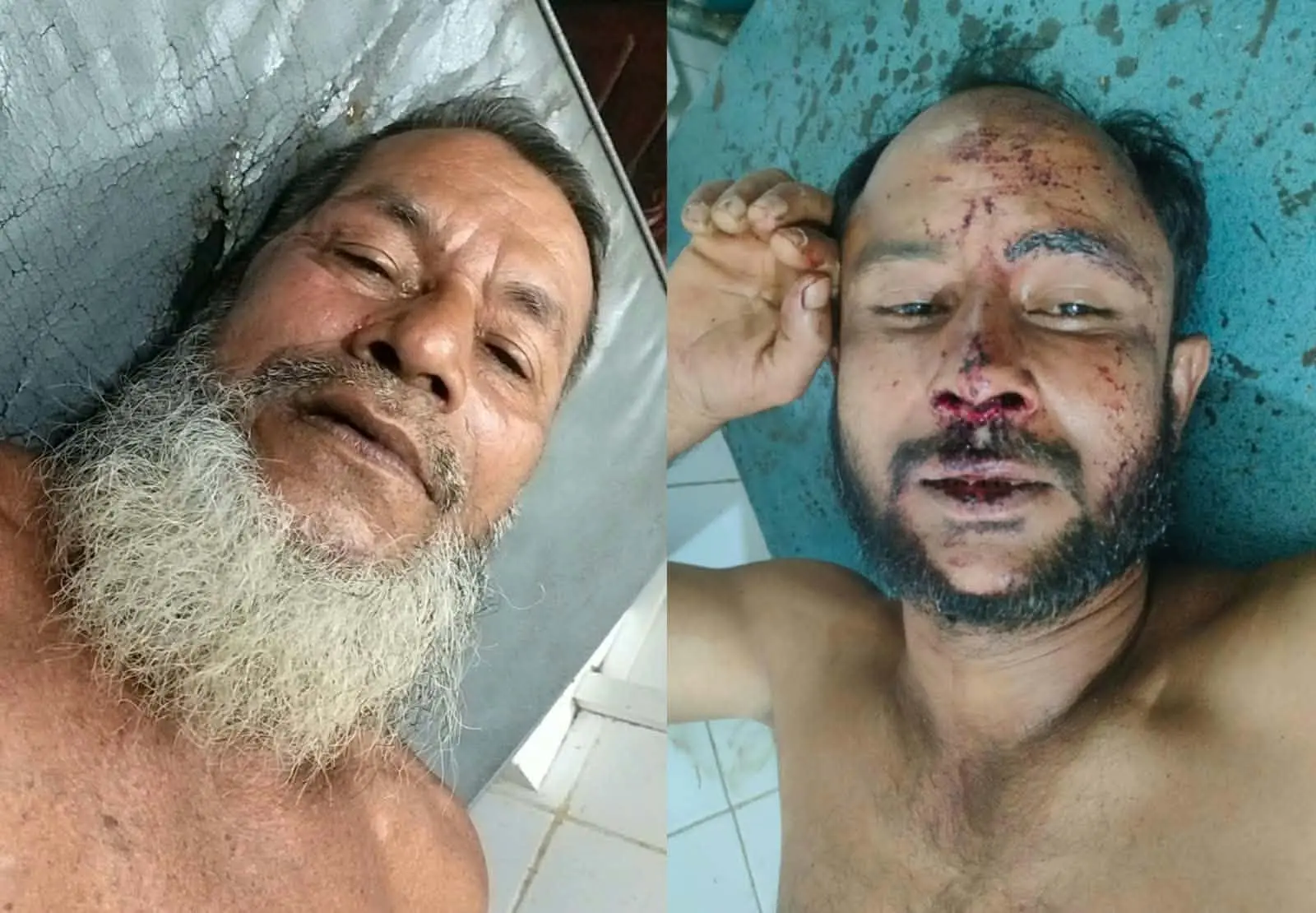 ইভটিজিং মামলায় জামিনে বেরিয়ে বাদীর ওপর হামলা, আহত ২