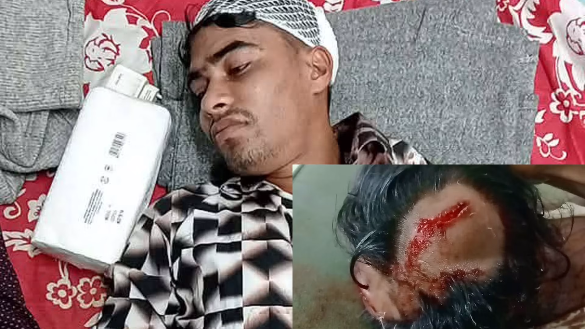 নাইক্ষ্যংছড়ির জামছড়িতে বহিরাগতদের হামলায় ছাত্রসহ আহত ৬, গ্রামবাসীর প্রতিবাদ
